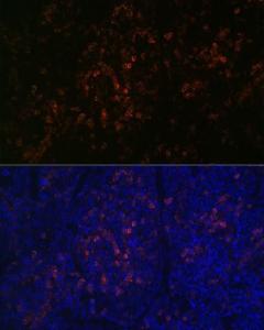 Immunofluorescence analysis of mouse spleen using Anti-BTK Antibody [ARC0485] (A308271) at a dilution of 1:100 (40X lens). DAPI was used to stain the cell nuclei (blue)