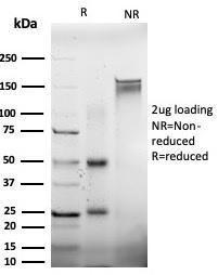 SDS-PAGE analysis of Anti-EIF2S1 Antibody [PCRP-EIF2S1-1E2] under non-reduced and reduced conditions; showing intact IgG and intact heavy and light chains, respectively. SDS-PAGE analysis confirms the integrity and purity of the antibody