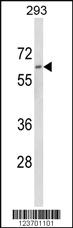 Anti-DOLK Rabbit Polyclonal Antibody