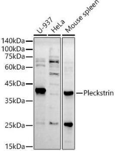 Western blot analysis of extracts of various cell lines, using Anti-Pleckstrin Antibody [ARC2870] (A307260) at 1:500 dilution. The secondary Antibody was Goat Anti-Rabbit IgG H&L Antibody (HRP) at 1:10000 dilution. Lysates/proteins were present at 25 µg per lane