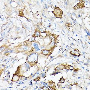 Anti-MMP7 Rabbit Polyclonal Antibody