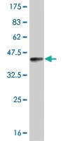 Anti-RORB Mouse Monoclonal Antibody [clone: 1D1]