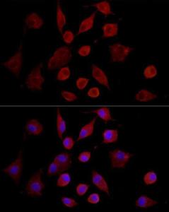 Anti-MMP7 Rabbit Polyclonal Antibody