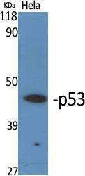 Western blot analysis of various cells using Anti-p53 Antibody