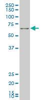 Anti-FOXO1 Mouse Monoclonal Antibody [clone: 4A10]