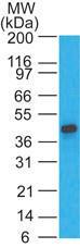 Anti-CCR1 Rabbit Polyclonal Antibody