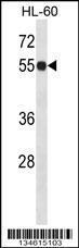 Anti-IMPDH1 Rabbit Polyclonal Antibody (FITC (Fluorescein Isothiocyanate))