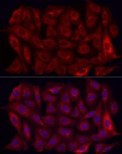 Anti-MMP7 Rabbit Polyclonal Antibody