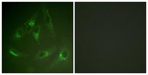 Immunofluorescence analysis of HeLa cells using Anti-CSFR Antibody. The right hand panel represents a negative control, where the antibody was pre-incubated with the immunising peptide