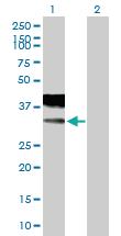 Anti-CACNG2 Mouse Polyclonal Antibody