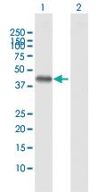 Anti-LECT1 Rabbit Polyclonal Antibody