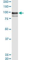 Anti-ENG Polyclonal Antibody Pair