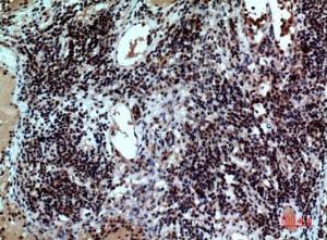 Immunohistochemical analysis of paraffin-embedded human Lymph nodes using Anti-CD47 Antibody