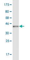 Anti-POU6F2 Mouse Monoclonal Antibody [clone: 1D3]