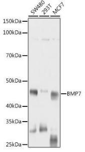 Anti-BMP7 antibody