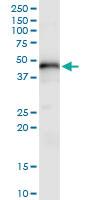 Anti-LECT1 Rabbit Polyclonal Antibody