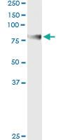 Anti-ENG Antibody Pair