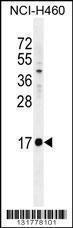 Anti-INS Rabbit Polyclonal Antibody (HRP (Horseradish Peroxidase))