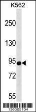 Anti-CSDE1 Rabbit Polyclonal Antibody (PE (Phycoerythrin))