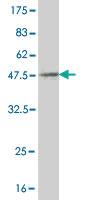 Anti-SSBP1 Mouse Monoclonal Antibody [clone: 4C1]