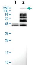 Anti-UTY Rabbit Polyclonal Antibody