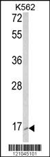 Anti-RAC2 Rabbit Polyclonal Antibody