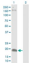 Anti-CLDN15 Rabbit Polyclonal Antibody