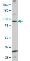 Anti-KSR2 Mouse Monoclonal Antibody [clone: 3F11]