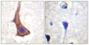 Immunohistochemical analysis of paraffin-embedded human brain tissue using Anti-CSFR Antibody. The right hand panel represents a negative control, where the antibody was pre-incubated with the immunising peptide