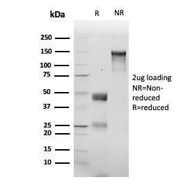 SDS-PAGE analysis of Anti-delta 1 Catenin Antibody [rCTNND1/6903] under non-reduced and reduced conditions; showing intact IgG and intact heavy and light chains, respectively. SDS-PAGE analysis confirms the integrity and purity of the antibody