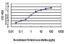 Anti-KSR2 Mouse Monoclonal Antibody [clone: 3F11]