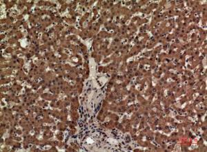 Immunohistochemical analysis of paraffin-embedded human liver using Anti-CD3E Antibody