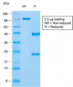 SDS-PAGE analysis of Anti-NAPSIN A Antibody [NAPSA/1865R] under non-reduced and reduced conditions; showing intact IgG and intact heavy and light chains, respectively. SDS-PAGE analysis confirms the integrity and purity of the antibody