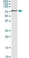 Anti-USP2 Polyclonal Antibody Pair