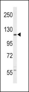 Anti-CSF1R Rabbit Polyclonal Antibody (AP (Alkaline Phosphatase))