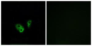 Immunofluorescence analysis of A549 cells using Anti-CNGA2 Antibody. The right hand panel represents a negative control, where the antibody was pre-incubated with the immunising peptide