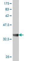 Anti-UBE2Q2 Mouse Polyclonal Antibody