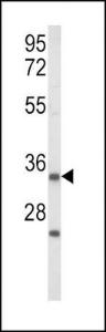 Anti-Insulin-Like Growth Factor Binding Protein 2 Rabbit Polyclonal Antibody (PE (Phycoerythrin))