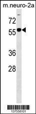 Anti-B4GALNT1 Rabbit Polyclonal Antibody (APC (Allophycocyanin))