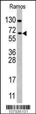 Anti-CDC25B Rabbit Polyclonal Antibody (AP (Alkaline Phosphatase))