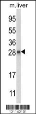 Anti-QDPR Rabbit Polyclonal Antibody