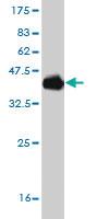 Anti-POU6F2 Mouse Monoclonal Antibody [clone: 8F9]