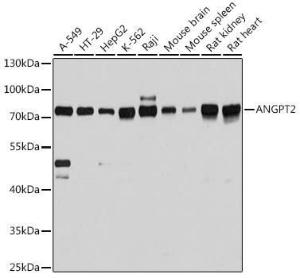 Western blot analysis of extracts of various cell lines, using Anti-Angiopoietin 2 / ANG2 Antibody (A12691) at 1:3,000 dilution. The secondary antibody was Goat Anti-Rabbit IgG H&L Antibody (HRP) at 1:10,000 dilution.