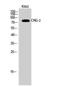 Western blot analysis of K562 cells using Anti-CNGA2 Antibody