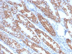 Immunohistochemical analysis of formalin-fixed, paraffin-embedded human stomach using Anti-delta 1 Catenin Antibody [rCTNND1/6903] at 2 µg/ml in PBS for 30 minutes at room temperature