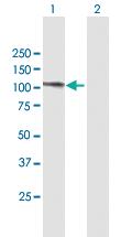 Anti-PRPF6 Mouse Polyclonal Antibody