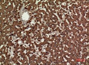 Immunohistochemical analysis of paraffin-embedded human liver using Anti-CD3E Antibody