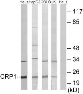 Western blot analysis of lysates from HeLa, HepG COLO, and Jurkat cells using Anti-CRP1 Antibody. The right hand lane represents a negative control, where the antibody is blocked by the immunising peptide