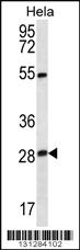 Anti-TSN Rabbit Polyclonal Antibody