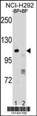 Anti-PARP1 Rabbit Polyclonal Antibody (APC (Allophycocyanin))